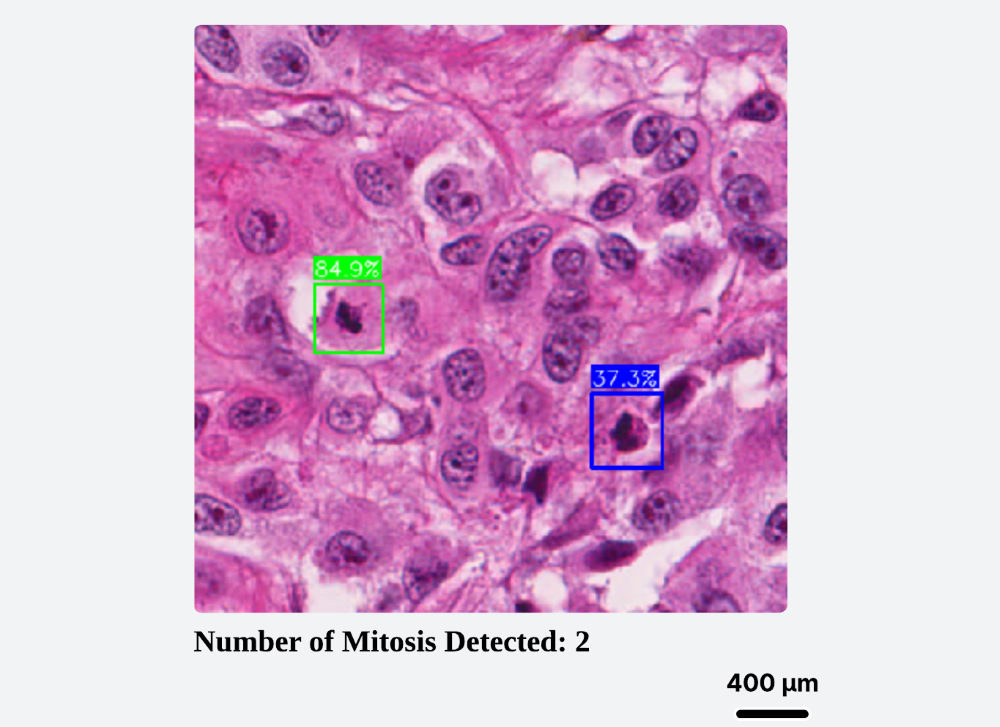 Mitosis detection screenshot